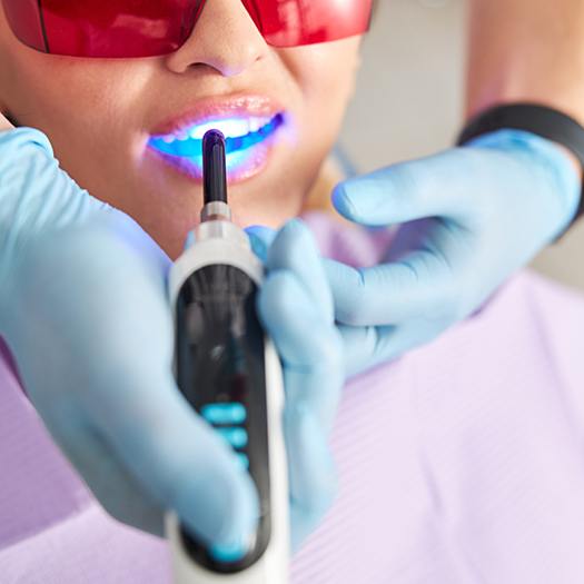 Gloved hands holding curing light close to patient’s tooth